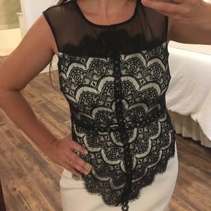 Black and white lace dress